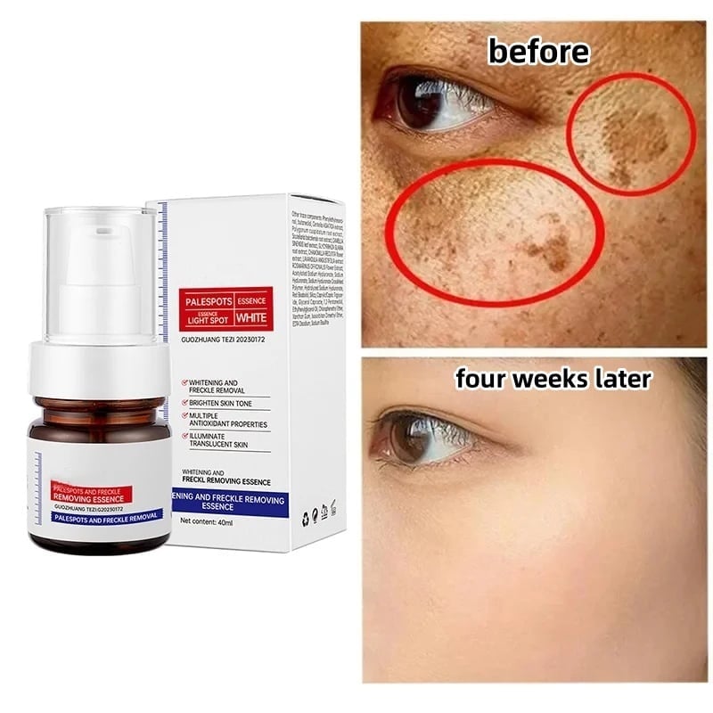 🔥Buy more save more🔥Vitamin C Whitening Freckles Face Cream Remove Melasma Dark Spots Lighten Melanin