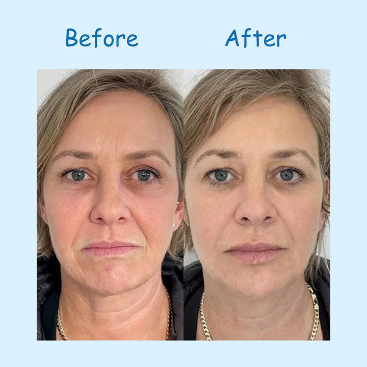 Hyaluronic Acid Powder, DIY Facial Serum, Skin Hydration Care Formula