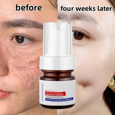 🔥Buy more save more🔥Vitamin C Whitening Freckles Face Cream Remove Melasma Dark Spots Lighten Melanin