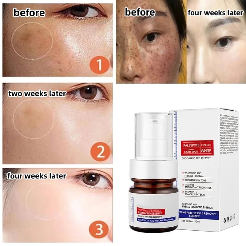 🔥Buy more save more🔥Vitamin C Whitening Freckles Face Cream Remove Melasma Dark Spots Lighten Melanin