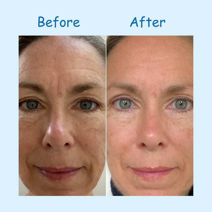 Hyaluronic Acid Powder, DIY Facial Serum, Skin Hydration Care Formula