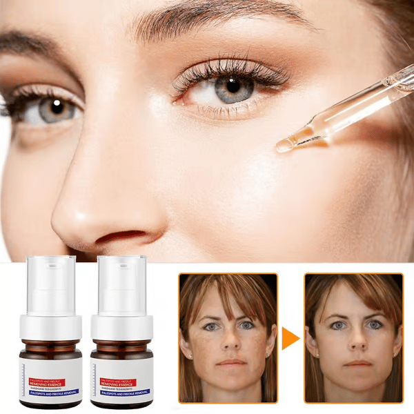 🔥Buy more save more🔥Vitamin C Whitening Freckles Face Cream Remove Melasma Dark Spots Lighten Melanin